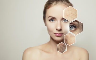 VI Peel Skin Care Benefits
